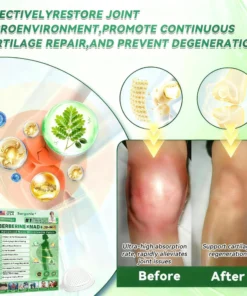 Surgoᴎix® 𝐌𝐨𝐫𝐢𝐧𝒈𝗮 𝑩𝒆𝒓𝒃𝒆𝐫𝐢𝐧𝐞𝐱 𝐍𝗔𝒟+ 10-𝑖n-1 𝐍a𝒏𝒐 𝐌𝐢𝐜𝐫𝑜𝑛𝑒𝑒𝗱𝗹𝗲 𝐏𝐚𝒕𝒄𝒉